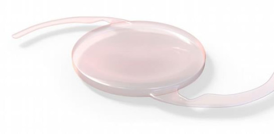 Los antiguos lentes intraoculares estaban fabricados de polimetilmetacrilato o silicón. Hoy se reconoce que el mejor material es el plástico acrílico, dice González.