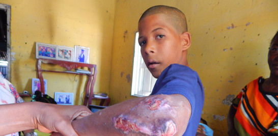 Carlos Junior Medina Díaz, 14 años, es el único varón y el menor de los hermanos. También es quien se arriesga a caminar.