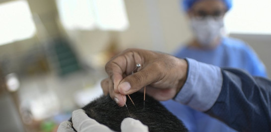 Un médico realiza terapia de acupuntura en un paciente de COVID-19 en recuperación. Foto: AP/Matías Delacroix.