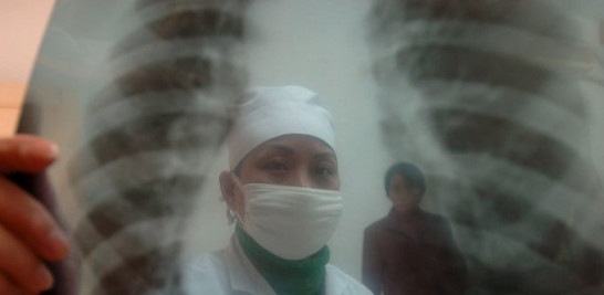 Un médico examina una radiografía de pulmones . EFE/Shou Sheng