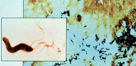 4.-Imagen de una fotografía de un microscopio donde se ve a la Helicobacter pilori. Foto cedida por Health Sciences Center-University of Virginia