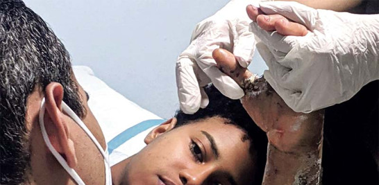 La adolescente Ashley lamenta cómo ha sido tratado su brazo en el Darío Contreras y pide al presidente Luis Abinader visitar ese hospital para que se entere de la realidad que viven los que van en busca de asistencia médica.