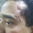Fotografía de Yépez Suncar tras ser agredido