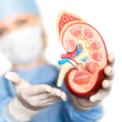El trasplante de riñón es la opción definitiva para los pacientes que padecen de insuficiencia renal crónica.