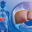 Experto advierte sobre el estigma social del cáncer de hígado: "Tradicionalmente se ha vinculado al alcoholismo"