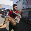 Los palestinos heridos en el bombardeo israelí de la Franja de Gaza