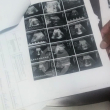 Fotografía muestra una de las Sonografías de los mellizos que esperaban la pareja de esposos que denunciaron que uno de los bebés les fue hurtado.