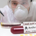 Es baja la probabilidad de que en RD haya ántrax, dice viceministro de Salud Colectiva