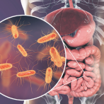 Estudio rastrea tumores de hasta 100 años para entender avance del cáncer intestinal