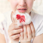 Hacen llamado a familias y sistemas de salud para el diagnóstico temprano de la hemofilia