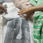 Jennifer Tavera, paciente del Jet Set, denuncia ya no tiene cobertura de Senasa para tratamiento