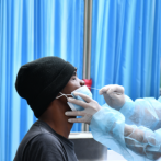 Aumentan tumores a nivel óseo en pacientes luego del Covid-19