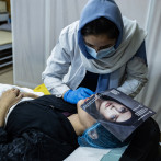 Las cirugías estéticas están de moda en Afganistán