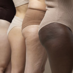 Combate las celulitis que salen en otoño