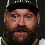 Tyson Fury, de 37 años, anuncia que saldrá del retiro en el 2026