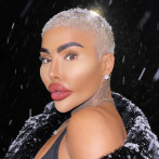 Muere a los 34 años Jordan James Parke, participante de 