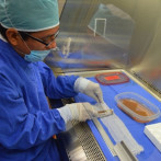 Buscan activar banco de piel en hospital Arturo Grullón