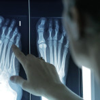 60% de los adultos padece deformidades en los dedos de los pies, advierten podólogos