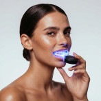 Lo que hay que saber del blanqueamiento dental en casa