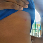 Hieren estudiante con objeto punzante en pelea en liceo de Duvergé