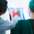 La importancia del diagnóstico precoz en el cáncer pulmonar