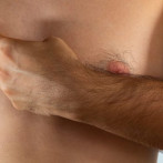 Cáncer de mama masculino: la edad aumenta el riesgo y el diagnóstico suele ser tardío
