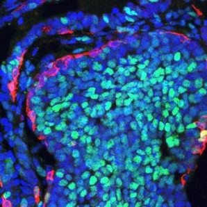 Imagen de un tumor de mama en ratón que muestra la segregación de ambas poblaciones celulares