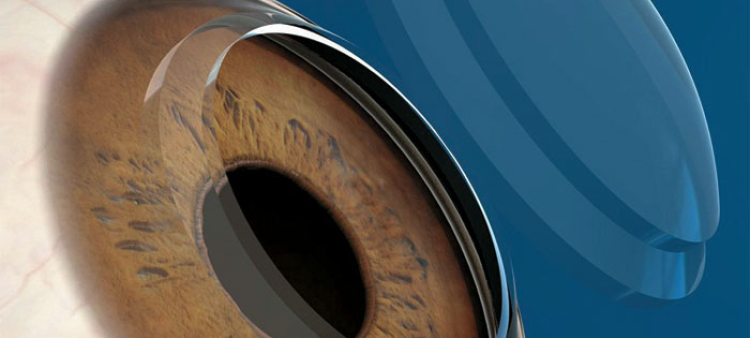 Organizadores. Llaman a todos los oftalmólogos a apoyar al Banco de Córneas y a trabajar en la creación de una cultura de donación.