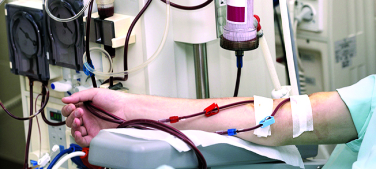 Las fístulas permiten recibir con mejor calidad los tratamientos de hemodiálisis.