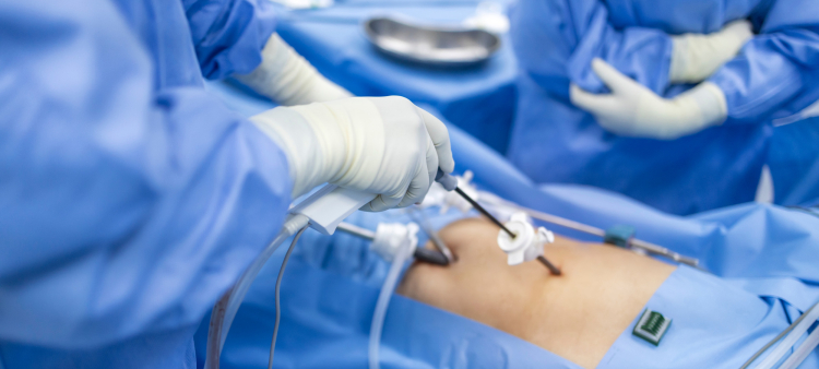 Las cirugías laparoscópicas son mínimamente invasivas y permiten una recuperación más rápida del paciente.