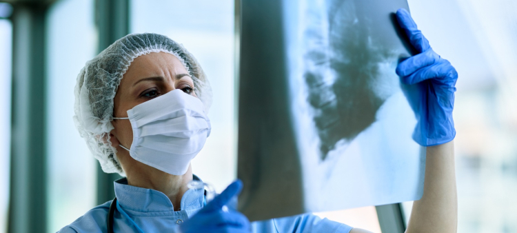 En la región de Centroamérica y el Caribe, la fibrosis pulmonar idiopática está teniendo un avance significativo, así como el cáncer pulmonar, incrementando su carga clínica en estos países.