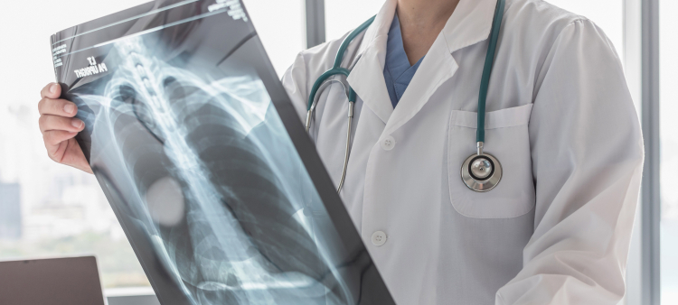 La hipertensión arterial pulmonar afecta mayormente a mujeres.