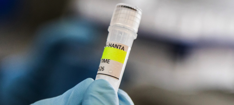 Esta fotografía, difundida por el Ministerio de Salud de Argentina, muestra a un científico del Instituto Malbrán sosteniendo un recipiente utilizado para diagnosticar el hantavirus andino.