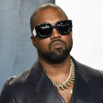Estudio británico ayuda a exfans de Kanye West a quitarse sus tatuajes