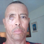 Oficial militar denuncia que quien lo entuertó sigue libre