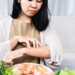 Testan con éxito en ratones una nueva vía para la alergia alimentaria: un fármaco del asma