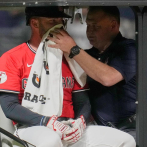 David Fry, de los Guardianes, sufre fracturas en la nariz y la cara tras pelotazo