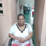 Mujer a la que le amputaron una pierna denuncia la desvincularon del Ministerio de Educación