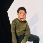 Adam Pearson, actor de “A Different Man”, responde a comediante que hizo un chiste sobre su físico