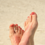 Consejos para presumir de pies y talones hidratados este verano