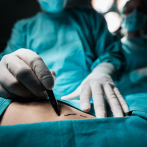 La calidad de vida de quienes se hacen cirugía bariátrica mejora en más del 80 %, según doctores