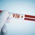 La vacunación terapéutica no suprime el VIH sin contar con antirretrovirales