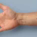 Científicos suizos crean “tatuaje biomédico” para detectar el cáncer