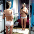 La anorexia puede empezar a gestarse desde el hogar, asegura experta