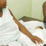 República Dominicana es líder mundial en nacimientos por cesáreas