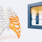 La bioimpresión 3D en la medicina personalizada