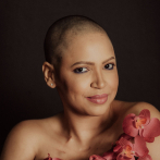 Juliana comparte fotos de su cabeza descubierta tras quimioterapia