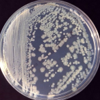 Bacterias en la Estación Espacial similares a infecciosas en hospitales