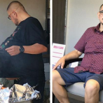 Extirpan tumor de 77 libras a hombre que creía que estaba gordo