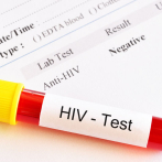 Eliminar la transmisión del VIH con innovación